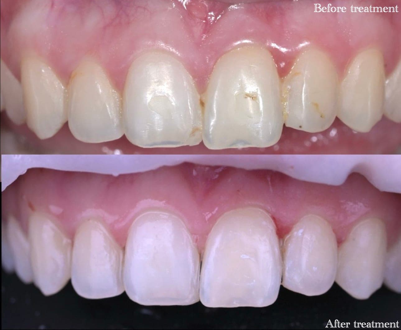 Federal-Dent — patient 1